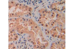 Used in DAB staining on fromalin fixed paraffin- embedded Kidney tissue (MTF1 抗体  (AA 2-164))