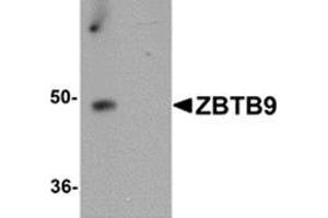Western blot analysis of ZBTB9 in mouse heart tissue lysate with ZBTB9 antibody at 1 μg/ml in (A) the absence and (B) the presence of blocking peptide. (ZBTB9 抗体  (C-Term))