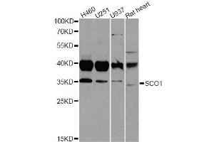 Western blot analysis of extracts of various cell lines, using SCO1 antibody. (SCO1 抗体  (AA 1-160))