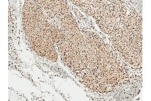 Immunohistochemistry analysis using Rabbit Anti-Alpha Synuclein pSer129 Polyclonal Antibody (ABIN5650951). (SNCA 抗体  (pSer129) (PerCP))