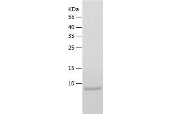 CCL1 Protein (AA 24-96) (His tag)