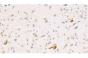 Detection of IL11Ra in Human Cerebrum Tissue using Polyclonal Antibody to Interleukin 11 Receptor Alpha (IL11Ra) (IL11RA 抗体  (AA 59-220))