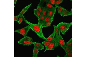 Immunofluorescence (IF) image for anti-Actin, alpha 2, Smooth Muscle, Aorta (ACTA2) (N-Term) antibody (ABIN6940521)