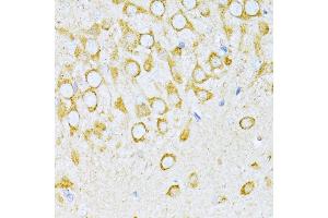 Immunohistochemistry (IHC) image for anti-Valyl-tRNA Synthetase (VARS) (AA 1-280) antibody (ABIN1683239)