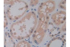 Immunohistochemistry (IHC) image for anti-Pancreas Specific Transcription Factor, 1a (PTF1A) (AA 177-328) antibody (ABIN7435103)