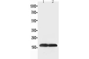Anti-Superoxide Dismutase 1 antibody, Western blotting Lane 1: COLO320 Cell Lysate Lane 2: SMMC Cell Lysate (SOD1 抗体  (C-Term))