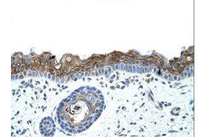 Image no. 1 for anti-Zinc Finger Protein 397 (ZNF397) (C-Term) antibody (ABIN202144) (ZNF397 抗体  (C-Term))