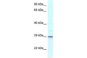 Western Blot showing Kcnip3 antibody used at a concentration of 1. (DREAM 抗体  (Middle Region))