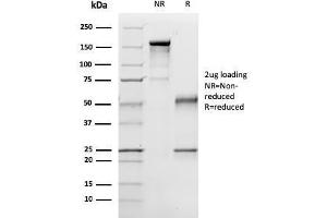 SDS-PAGE Analysis Purified p57 Mouse Monoclonal Antibody (57P06). (CDKN1C 抗体)