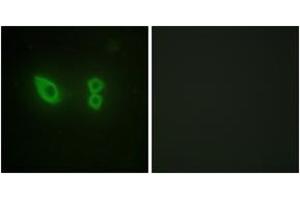 Immunofluorescence analysis of HeLa cells, using Actinin alpha-2/3 Antibody. (ACTN2/3 抗体  (AA 31-80))