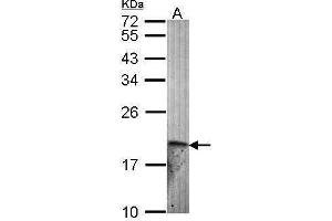 WB Image Sample (30 ug of whole cell lysate) A: Hela 12% SDS PAGE antibody diluted at 1:1000 (Endothelin 2 抗体)