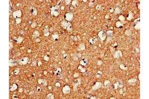 Immunohistochemistry of paraffin-embedded human brain tissue using ABIN7155209 at dilution of 1:100 (HMGB2 抗体  (AA 43-185))