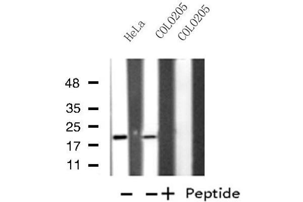 MRPL49 抗体  (Internal Region)
