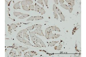 Immunoperoxidase of monoclonal antibody to HCAP-G on formalin-fixed paraffin-embedded human skeletal muscle. (NCAPG 抗体  (AA 336-435))