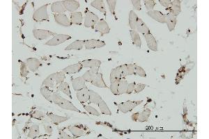 Immunoperoxidase of monoclonal antibody to HCAP-G on formalin-fixed paraffin-embedded human skeletal muscle. (NCAPG 抗体  (AA 336-435))