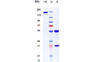 Anti-Complement C2 Reference Antibody (ARGX-117) on SDS-PAGE under reducing (R) condition. (Recombinant Complement C2 抗体)