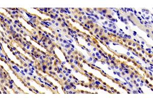 Detection of gp130 in Rat Kidney Tissue using Polyclonal Antibody to Glycoprotein 130 (gp130)