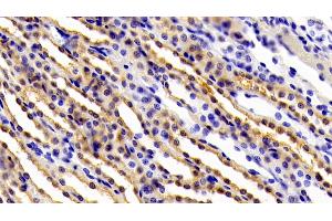 Detection of gp130 in Rat Kidney Tissue using Polyclonal Antibody to Glycoprotein 130 (gp130) (CD130/gp130 抗体  (AA 26-323))