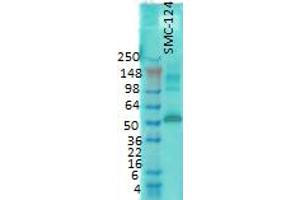 western rat membrane 1 in 1000 CaMKII. (CAMKII gamma 抗体)