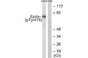 Lane 1: The extracts from K562 cells treated with Na3VO4 (0.