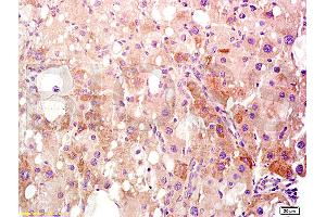 Formalin-fixed and paraffin embedded rat liver tissue labeled Anti-HMGB1 Polyclonal Antibody, Unconjugated (ABIN671616) at 1:400, followed by conjugation to the secondary antibody and DAB staining (HMGB1 抗体  (AA 75-170))