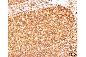 IHC testing of human tonsil (10X) stained with CD45RB antibody (PD7/26). (CD45RB 抗体)