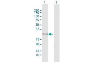Western Blot analysis of DHRS9 expression in transfected 293T cell line by DHRS9 MaxPab polyclonal antibody. (DHRS9 抗体  (AA 1-319))