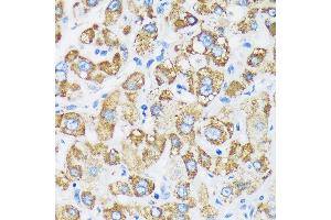 Immunohistochemistry of paraffin-embedded Human liver using GTPBP8 Rabbit pAb (ABIN7267527) at dilution of 1:100 (40x lens). (GTPBP8 抗体  (AA 1-170))