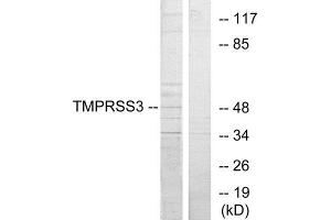 Western Blotting (WB) image for anti-Transmembrane Protease, Serine 3 (TMPRSS3) (C-Term) antibody (ABIN1849485) (TMPRSS3 抗体  (C-Term))