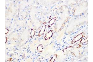 Immunohistochemistry of paraffin-embedded rat kidney using Aconitase 2   Rabbit mAb (ABIN7265379) at dilution of 1:100 (40x lens). (ACO2 抗体)