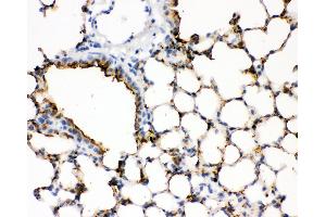 IHC analysis of SFTPA1 using anti- SFTPA1 antibody . (Surfactant Protein A1 抗体  (C-Term))