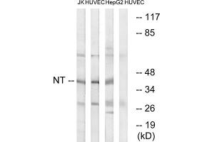 Western blot analysis of extracts from Jurkat cells, HUVEC cells and HepG2 cells, using NT antibody. (NT (C-Term) 抗体)