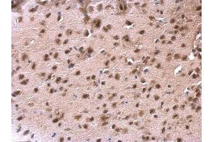 IHC-P Image DDX1 antibody [N3C2], Internal detects DDX1 protein at nucleus on mouse fore brain by immunohistochemical analysis. (DDX1 抗体  (Internal Region))