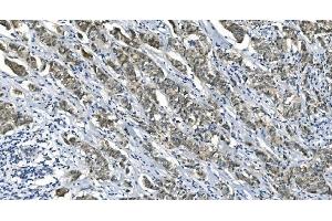 IHC analysis of eRF1/ETF1 using anti-eRF1/ETF1 antibody (ABIN7602625).