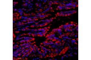 Immunofluorescence of paraffin embedded rat lung using C1orf173 (ABIN7074073) at dilution of 1: 650 (350x lens) (Glutamate-Rich Protein 3 (ERICH3) 抗体)