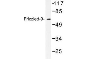 Image no. 1 for anti-Frizzled Family Receptor 9 (FZD9) antibody (ABIN317735) (FZD9 抗体)