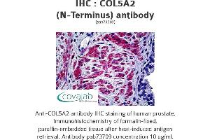 Image no. 1 for anti-Collagen, Type V, alpha 2 (COL5A2) antibody (ABIN1733201) (COL5A2 抗体)