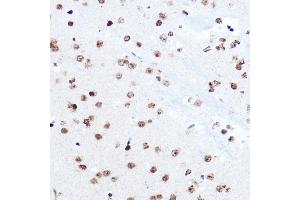 Immunohistochemistry of paraffin-embedded mouse brain using SETD5 Rabbit pAb (ABIN6132960, ABIN6147644, ABIN6147646 and ABIN6223140) at dilution of 1:100 (40x lens). (SETD5 抗体  (AA 520-740))