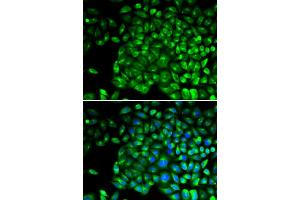 Immunofluorescence analysis of U2OS cells using TNFR2/TNFR2/TNFRSF1B antibody (ABIN1683061, ABIN3015125, ABIN3015126 and ABIN6213832). (TNFRSF1B 抗体  (AA 30-250))