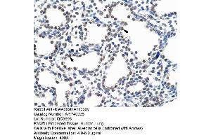 ARP40336 Paraffin Embedded Tissue: Human Lung Cellular Data: Alveolar cells Antibody Concentration: 4. (KIAA0020 抗体  (N-Term))