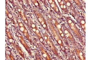 Immunohistochemistry of paraffin-embedded human small intestine tissue using ABIN7175150 at dilution of 1:100 (USHBP1 抗体  (AA 1-260))