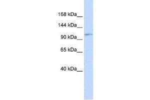 Western Blot showing AVIL antibody used at a concentration of 1-2 ug/ml to detect its target protein. (Advillin 抗体  (Middle Region))