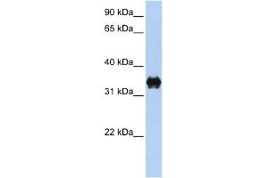 WB Suggested Anti-PYCR2 Antibody Titration: 0. (PYCR2 抗体  (C-Term))