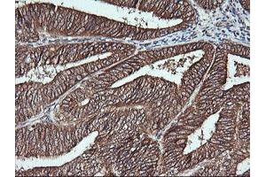 Image no. 2 for anti-Musashi Homolog 2 (MSI2) antibody (ABIN1499578) (MSI2 抗体)
