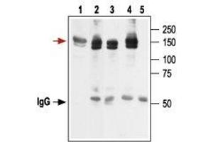 Immunoprecipitation (IP) image for anti-Potassium Voltage-Gated Channel, Subfamily H (Eag-Related), Member 2 (KCNH2) (AA 1106-1159), (Intracellular) antibody (ABIN7043544)