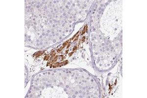 Immunohistochemical staining of human testis shows strong cytoplasmic positivity in Leydig cells.