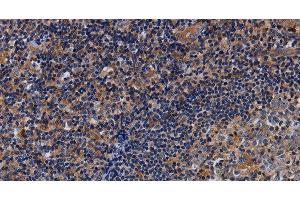 Immunohistochemistry of paraffin-embedded Human tonsil using LIMS1 Polyclonal Antibody at dilution of 1:40 (LIMS1 抗体)