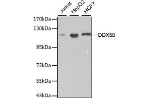 Western blot analysis of extracts of various cell lines, using DDX58 antibody. (DDX58 抗体)