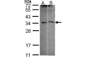 WB Image Sample (30 ug of whole cell lysate) A: 293T B: Raji 12 % SDS PAGE antibody diluted at 1:1000 (FHL5 抗体)
