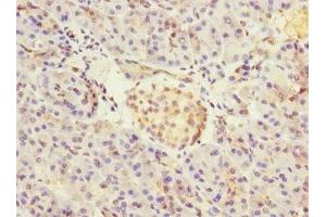 Immunohistochemistry of paraffin-embedded human pancreatic tissue using ABIN7149054 at dilution of 1:100 (CRIP2 抗体  (AA 1-208))
